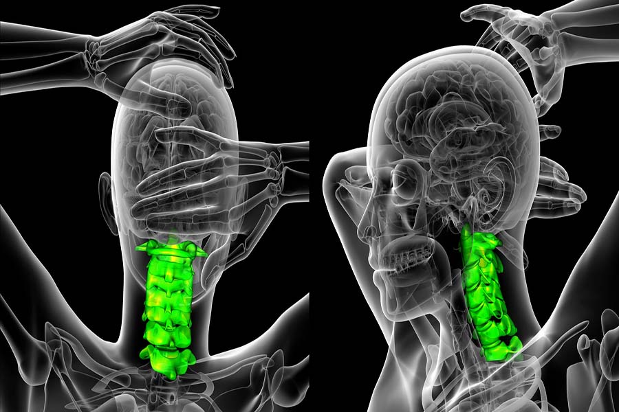 Spine Rheumatoid Arthritis: Symptoms and Treatment