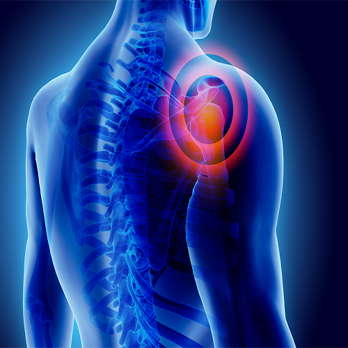 Diagnosis of shoulder pain