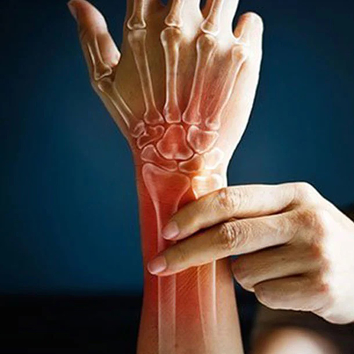 Rheumatoid